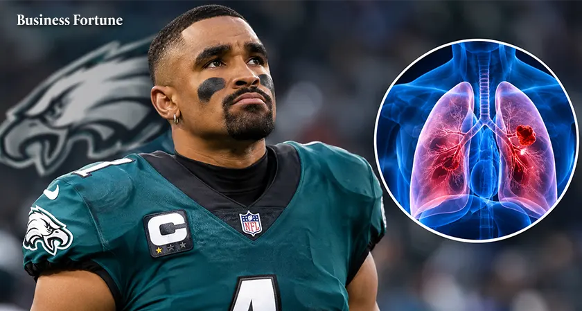  Jalen Hurts Has Blood Clots in Lungs, Expected to Miss Eagles' Season 